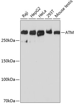 ATM Rabbit monoclonal antibody