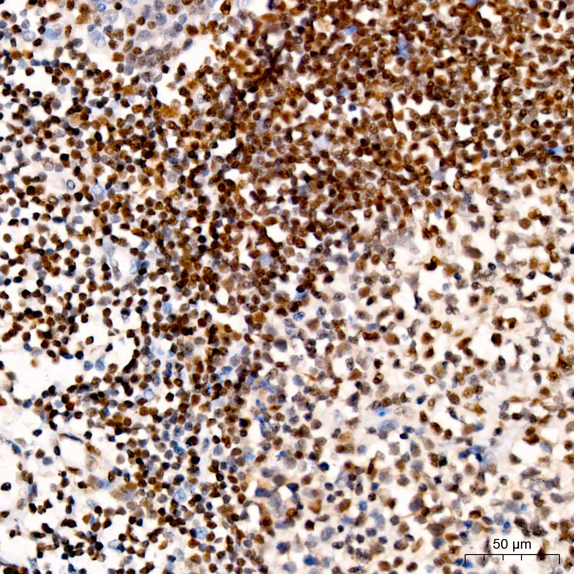 ATM Rabbit monoclonal antibody
