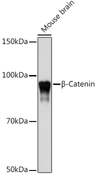 [KO Validated] B Beta-Catenin Rabbit monoclonal antibody