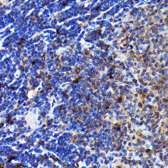 Caspase-3 Rabbit monoclonal antibody
