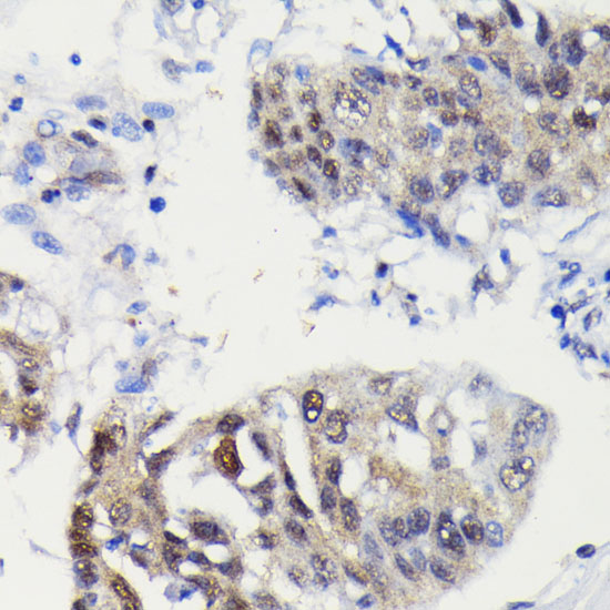 Caspase-3 Rabbit monoclonal antibody