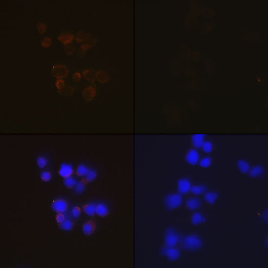 Caspase-3 Rabbit monoclonal antibody