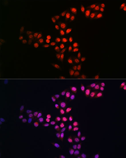 [KO Validated] SIRT1 Rabbit monoclonal antibody