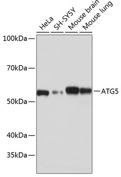 [KO Validated] ATG5 Rabbit monoclonal antibody