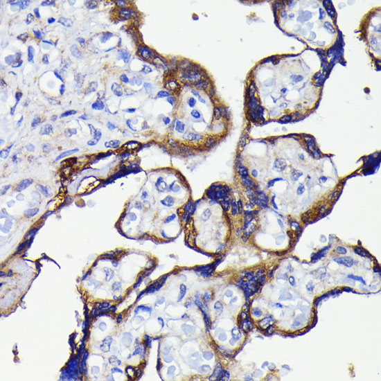 [KO Validated] ATG5 Rabbit monoclonal antibody