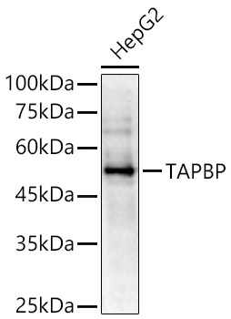 TAPBP Rabbit polyclonal antibody
