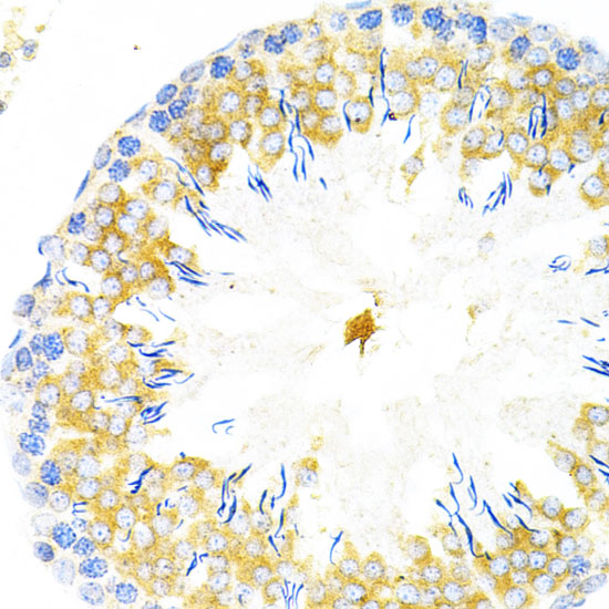TAPBP Rabbit polyclonal antibody