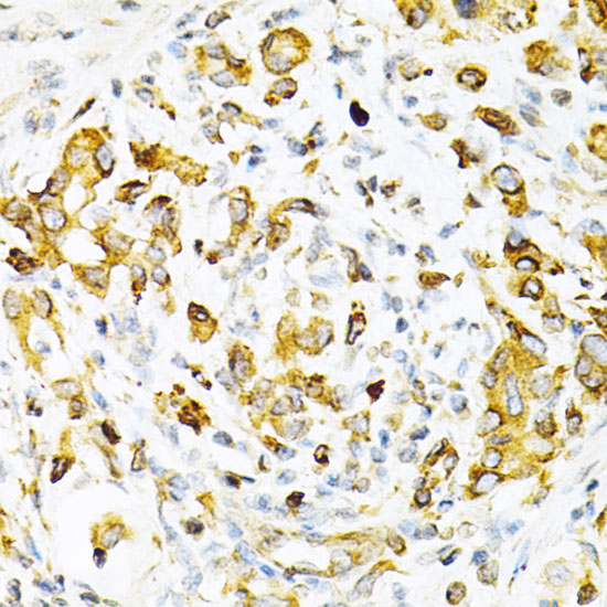 TAPBP Rabbit polyclonal antibody