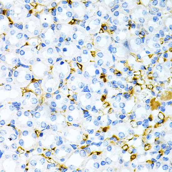 TAPBP Rabbit polyclonal antibody