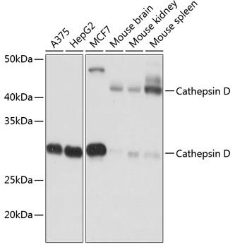 Cathepsin D Rabbit monoclonal antibody