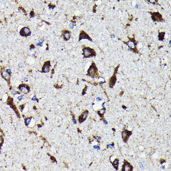 Cathepsin D Rabbit monoclonal antibody
