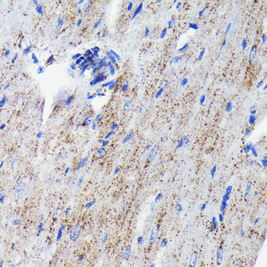 Cathepsin D Rabbit monoclonal antibody