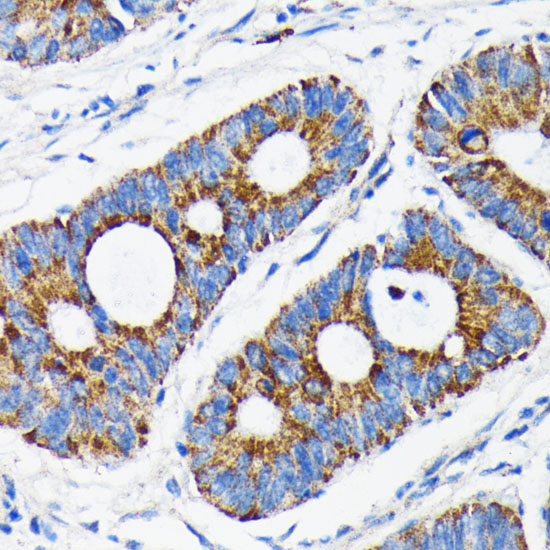 [KO Validated] Bax Rabbit monoclonal antibody