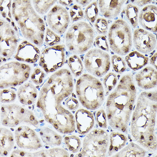 Ubiquitin Rabbit monoclonal antibody