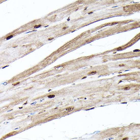 Ubiquitin Rabbit monoclonal antibody
