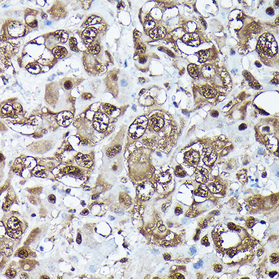 Ubiquitin Rabbit monoclonal antibody