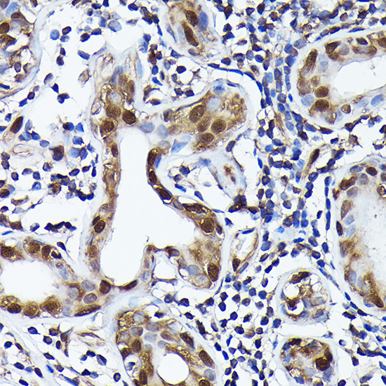 Ubiquitin Rabbit monoclonal antibody