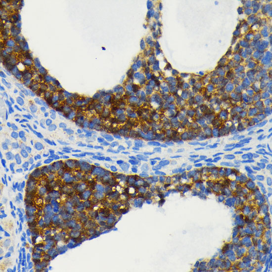 [KO Validated] cIAP1 Rabbit monoclonal antibody