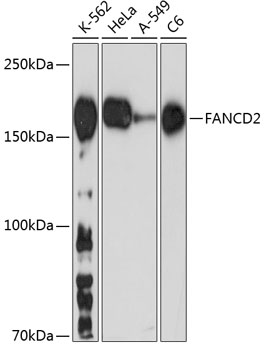 FANCD2 Rabbit monoclonal antibody