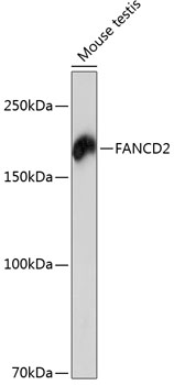 FANCD2 Rabbit monoclonal antibody