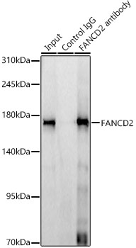 FANCD2 Rabbit monoclonal antibody