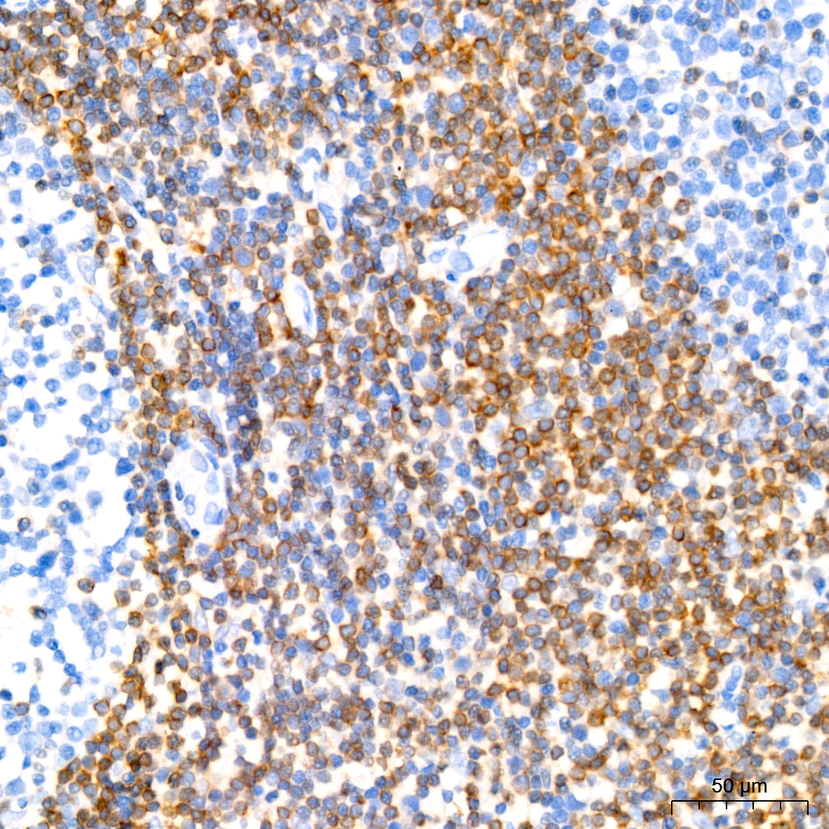 [KD Validated] Bcl-2 Rabbit monoclonal antibody