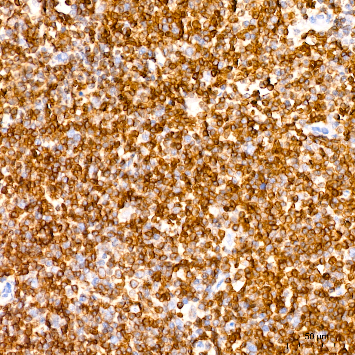[KD Validated] Bcl-2 Rabbit monoclonal antibody