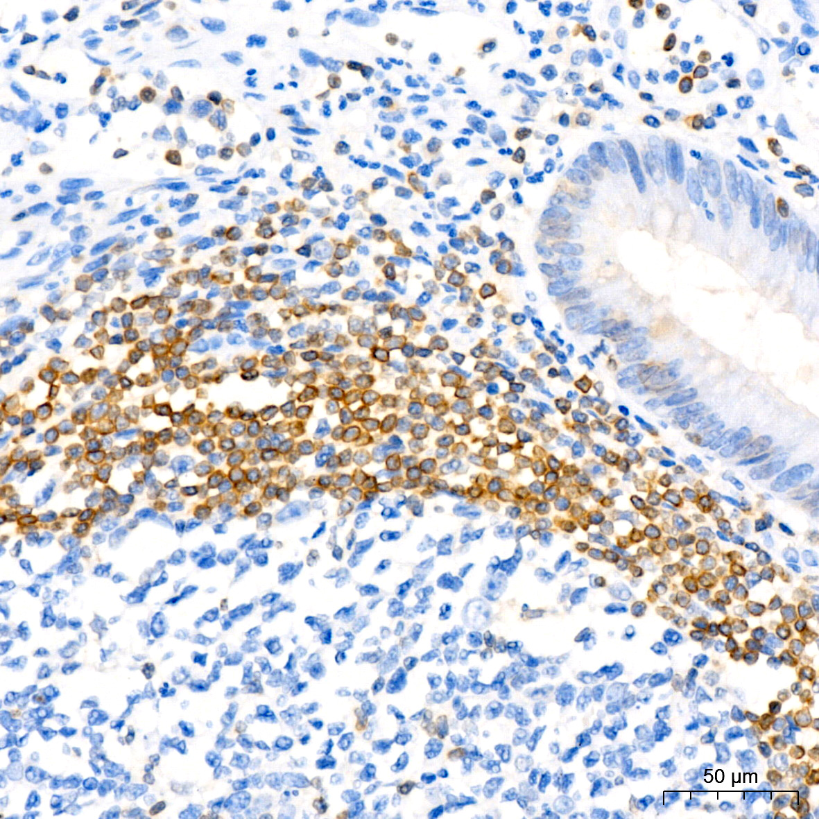 [KD Validated] Bcl-2 Rabbit monoclonal antibody