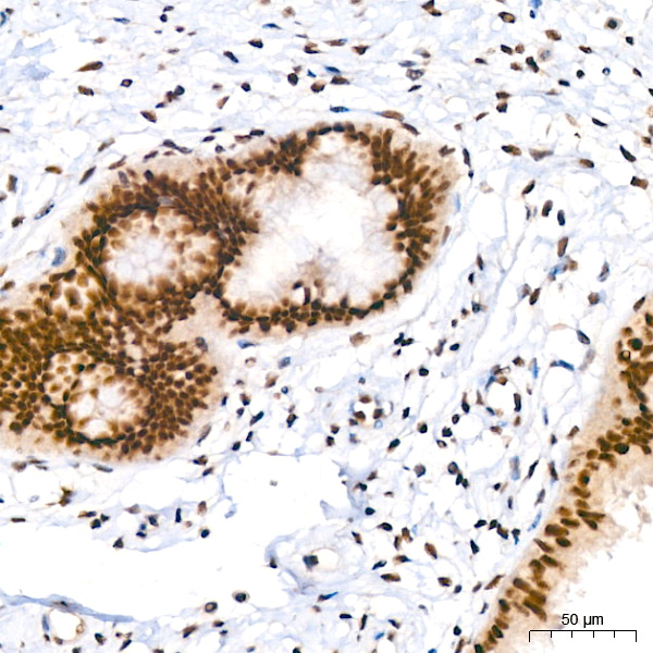 PIM1 Rabbit monoclonal antibody