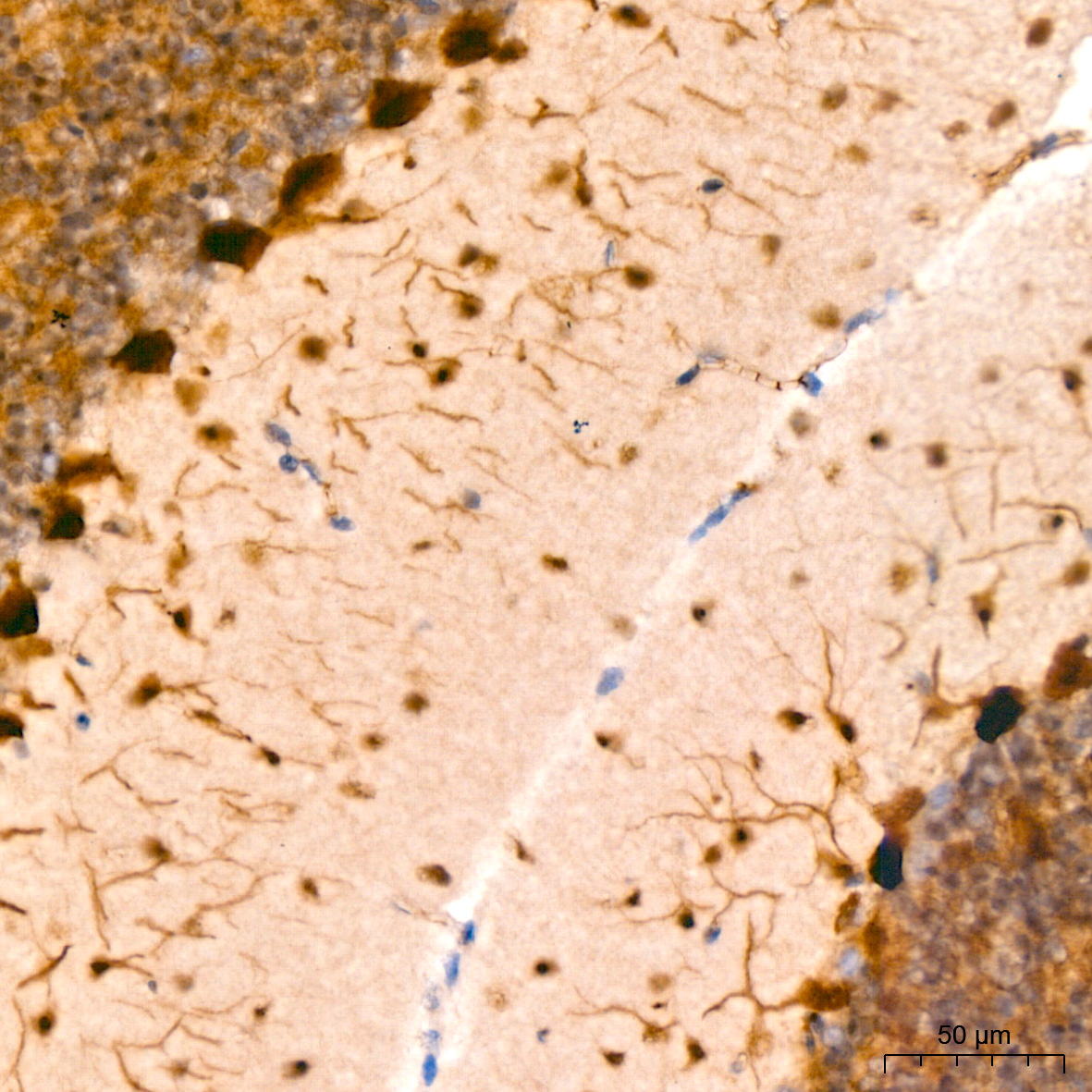 PIM1 Rabbit monoclonal antibody