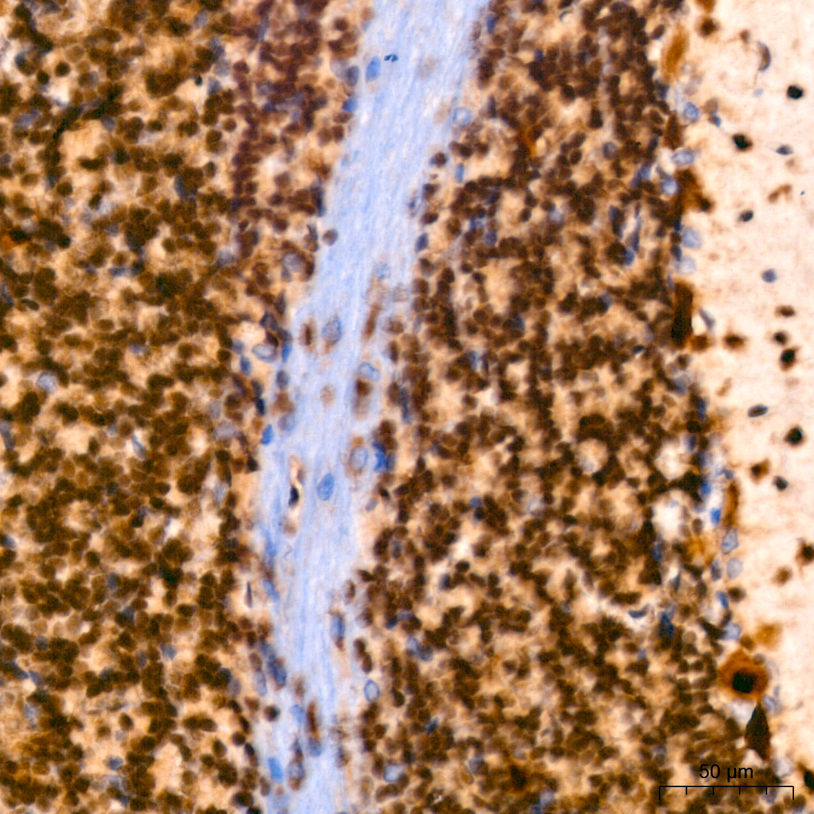 PIM1 Rabbit monoclonal antibody