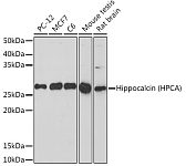 Western blot - Hippocalcin (HPCA) Rabbit mAb (A19696)