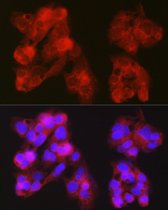 NR1I3 Rabbit polyclonal antibody