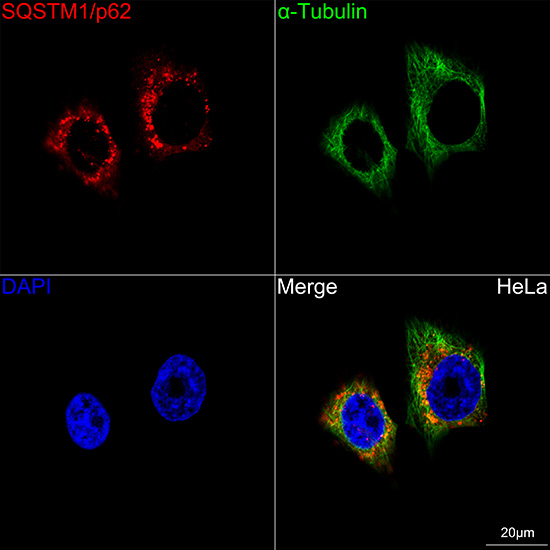 ABclonal:Immunofluorescence - SQSTM1/p62 Rabbit mAb (A19700)