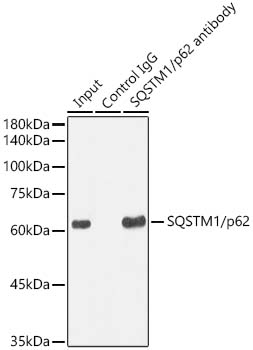 ABclonal:Immunoprecipitation - SQSTM1/p62 Rabbit mAb (A19700)