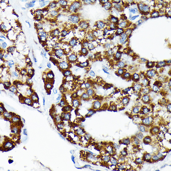 HSPA4 Rabbit monoclonal antibody