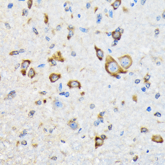 HSPA4 Rabbit monoclonal antibody