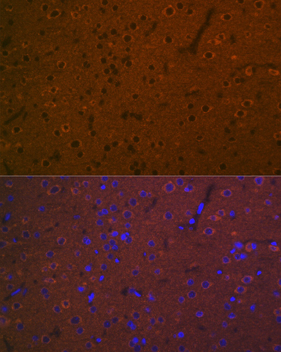 5HT7 Receptor Rabbit monoclonal antibody