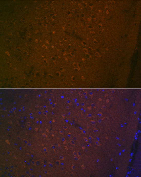 5HT7 Receptor Rabbit monoclonal antibody