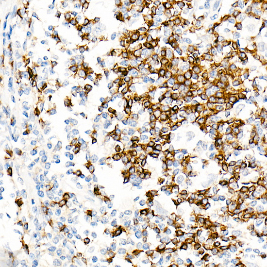 IGHD Rabbit monoclonal antibody
