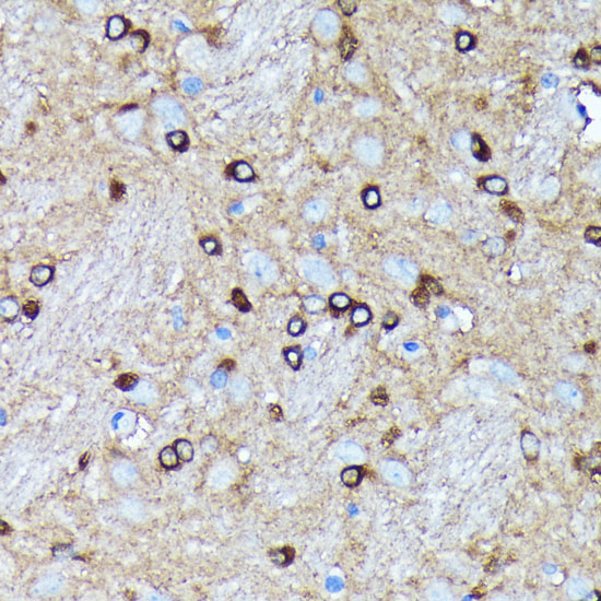 Argonaute-2 Rabbit monoclonal antibody