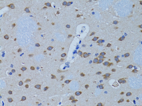 PLCB1 Rabbit polyclonal antibody