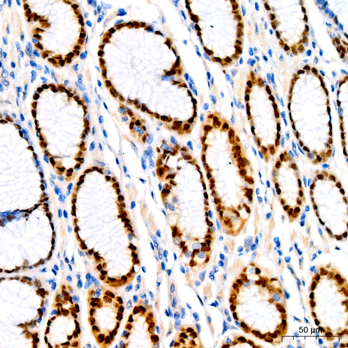 SOX9 Rabbit monoclonal antibody