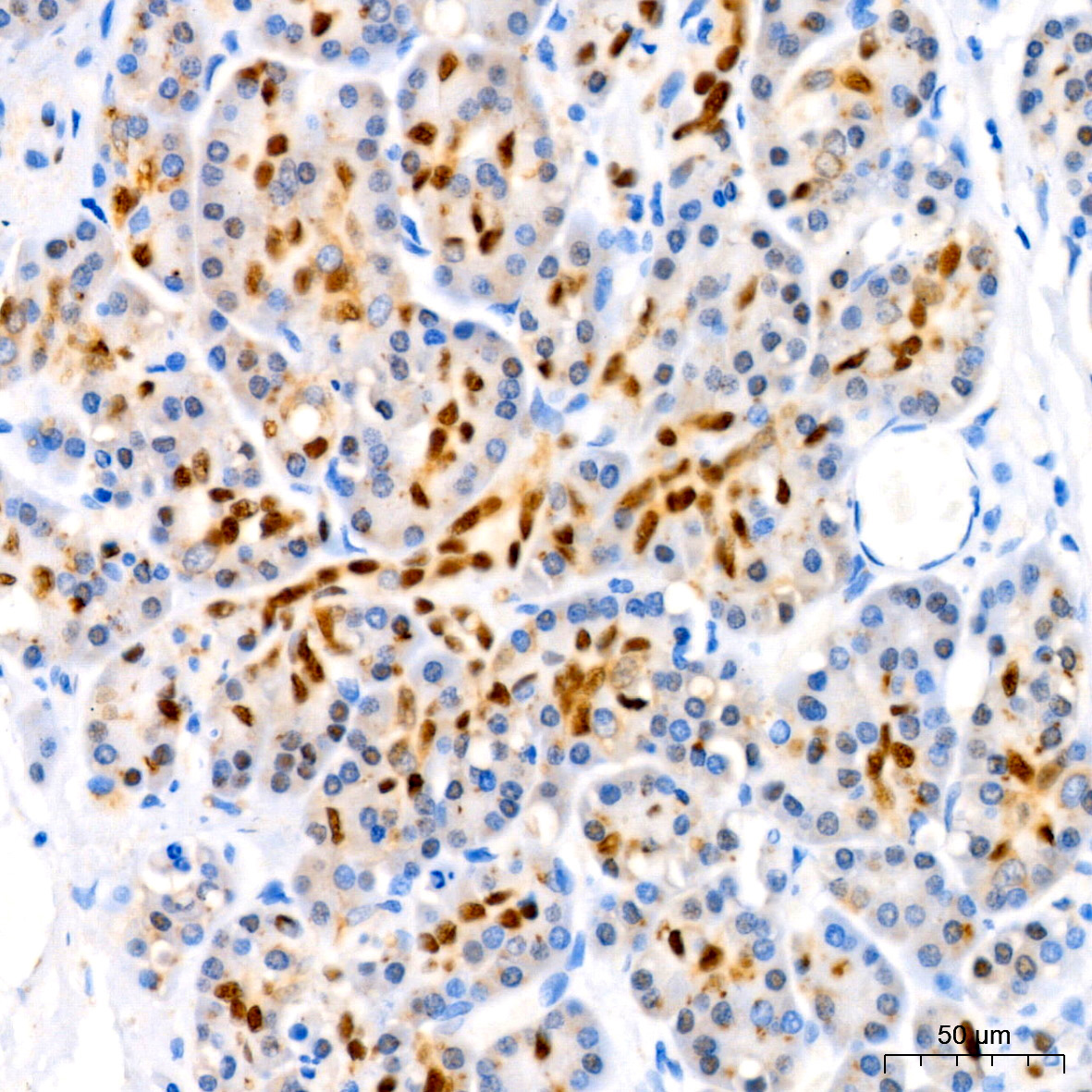 SOX9 Rabbit monoclonal antibody