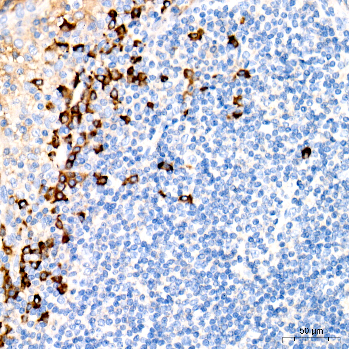 Human IgG Rabbit monoclonal antibody