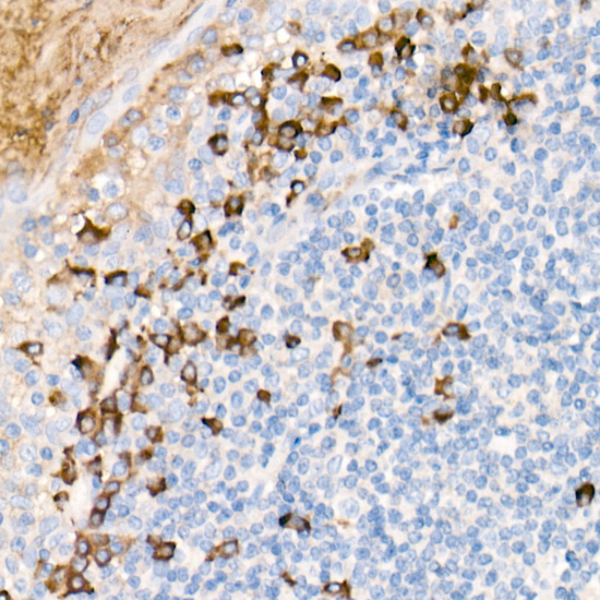 Human IgG Rabbit monoclonal antibody