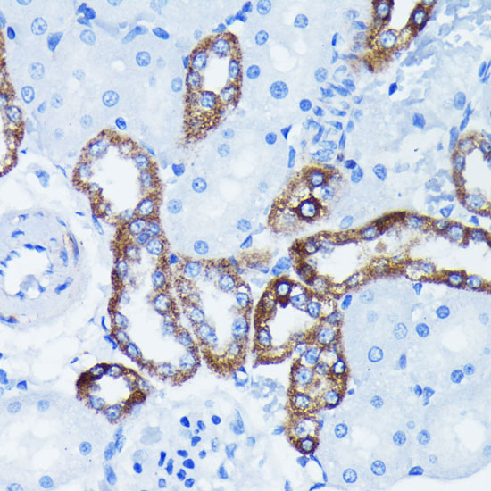 IK KappaBA Alpha Rabbit monoclonal antibody
