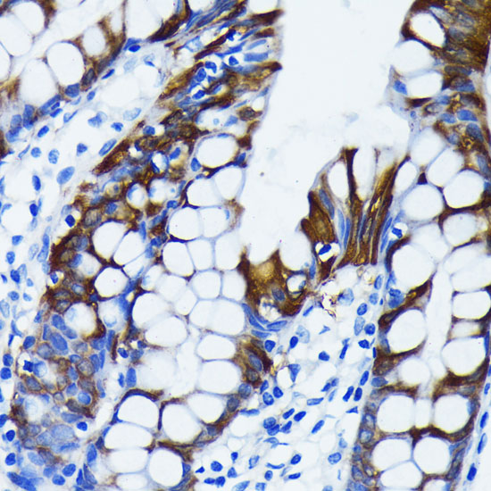 IK KappaBA Alpha Rabbit monoclonal antibody