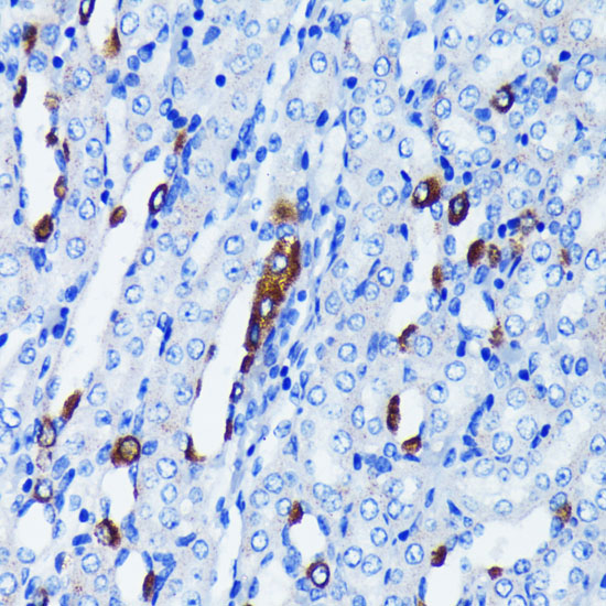 IK KappaBA Alpha Rabbit monoclonal antibody