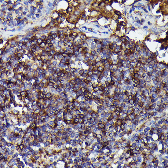Human IgM Rabbit monoclonal antibody
